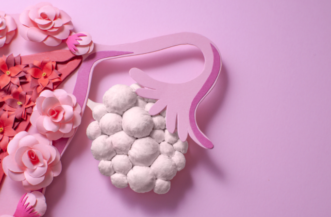 adan-zye-yumurtalik-kisti