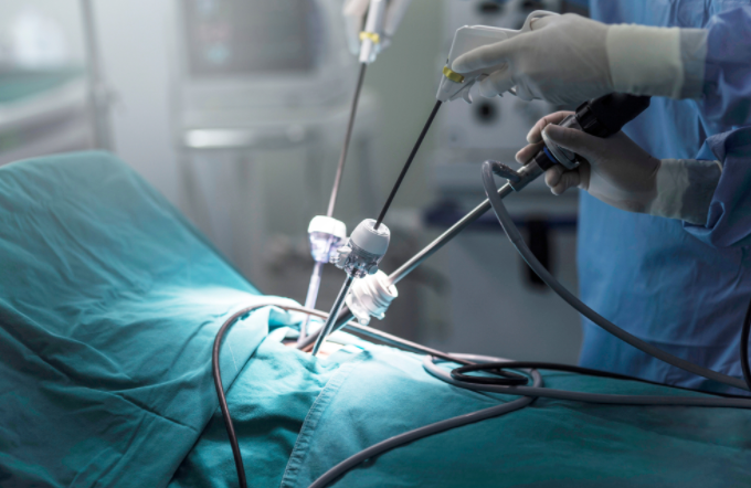 endoskopik-cerrahiler-histeroskopi-laparoskopi