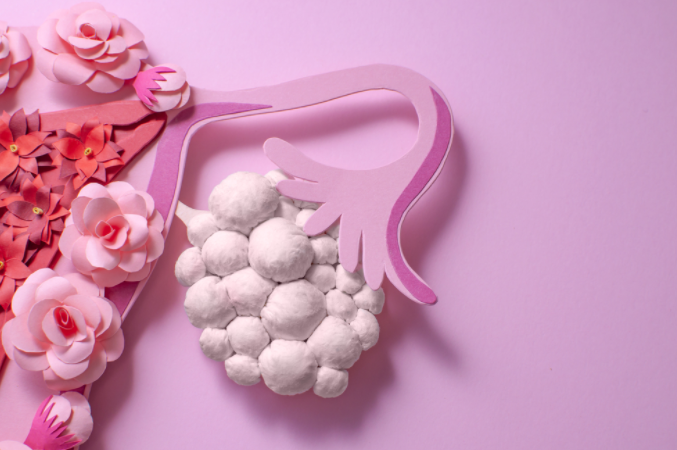 polikistik-over-sendromu-olan-kisiler-cocuk-sahibi-olabilir-mi