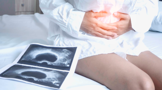 yumurtalik-kistleri-nedir-ve-tedavisi-nelerdir